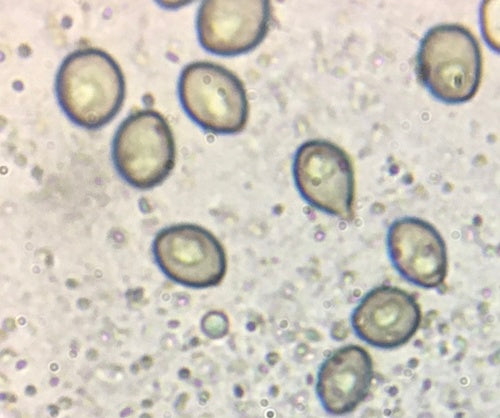 Borstenkugelpilz — Bild 2